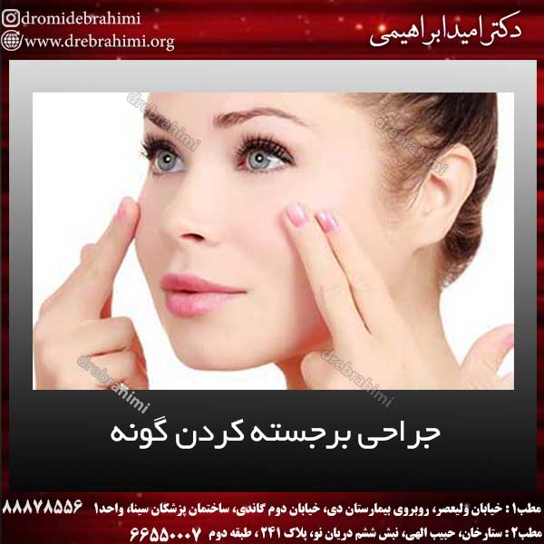 جراحی برجسته کردن گونه