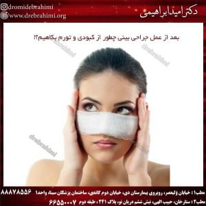 بعد از عمل جراحی بینی چطور از کبودی و تورم بکاهیم؟! 
