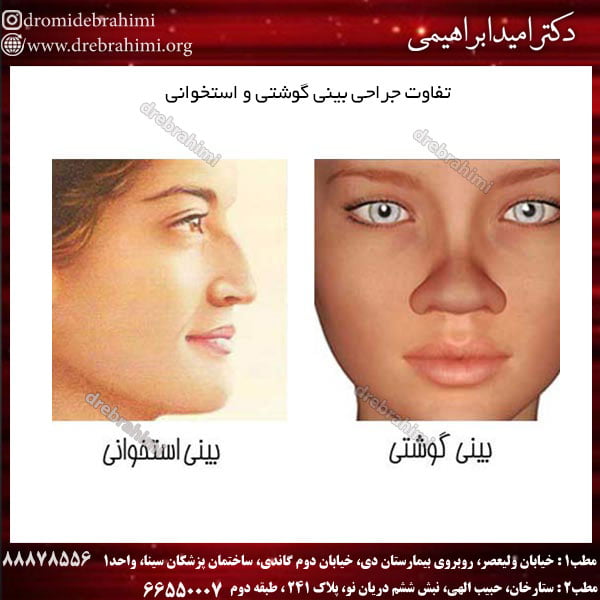 تفاوت جراحی بینی گوشتی و استخوانی