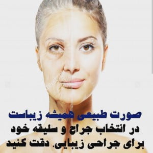 جراحی بینی طبیعی