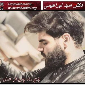 رینوپلاستی بینی