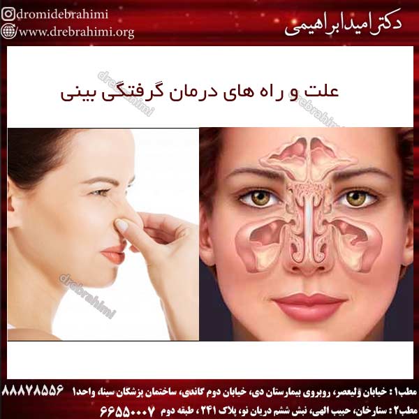 علت و راه های درمان گرفتگی بینی
