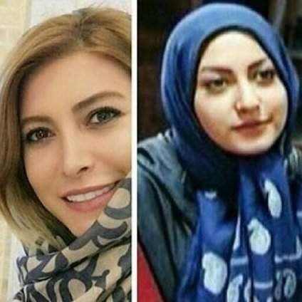 عملی بینی در بازیگران