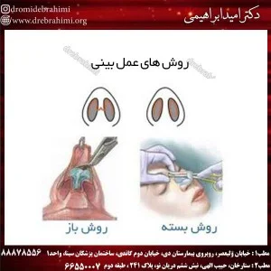 روش های عمل بینی