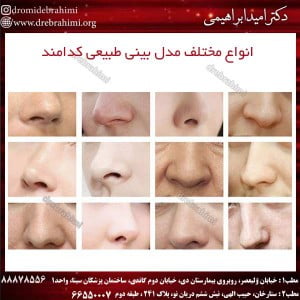 انواع-مختلف-مدل-بینی-طبیعی-کدامند