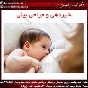 شیردهی-و-جراحی-بینی