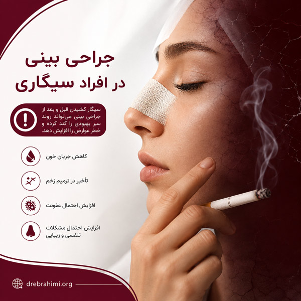 جراحی بینی در افراد سیگاری - دکتر امید ابراهیمی