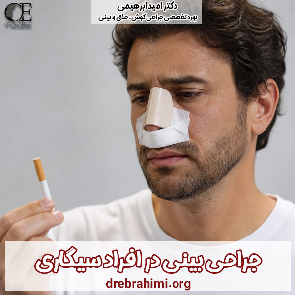 جراحی بینی در افراد سیگاری - دکتر امید ابراهیمی