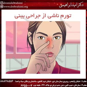 تورم ناشی از جراحی بینی