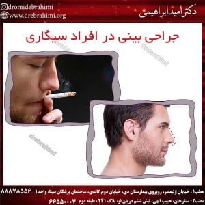 جراحی-بینی-در-افراد-سیگاری