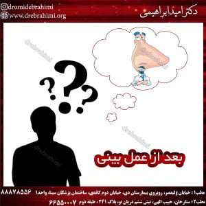 عد از عمل بینی