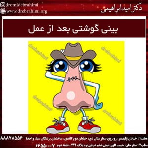 بینی گوشتی بعد از عمل