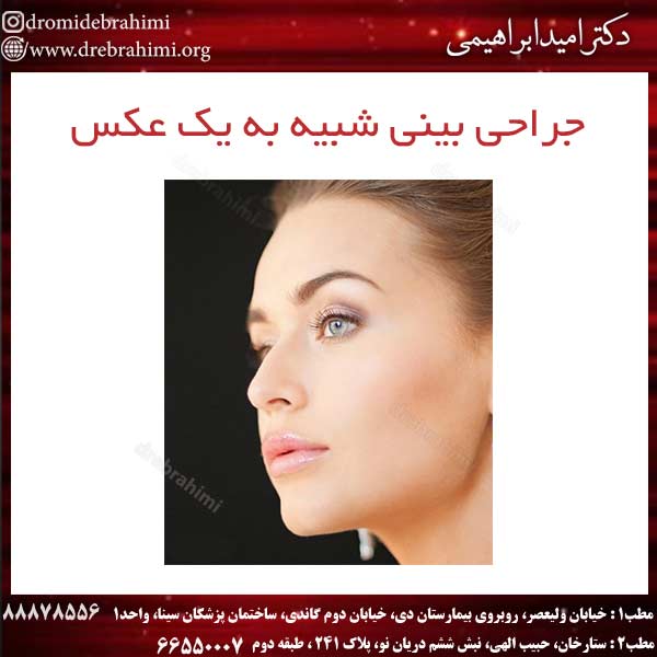 جراحی بینی شبیه به یک عکس
