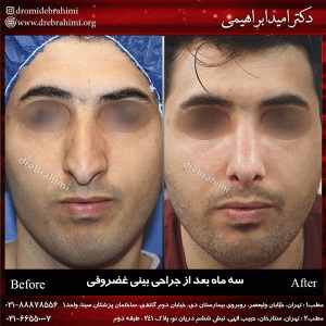 جراحی بینی تهران