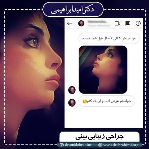 جراحی بینی تهران