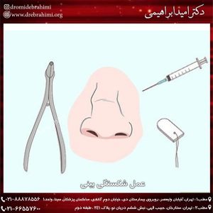 عمل شکستگی بینی