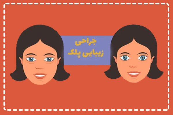 جراحی پلک