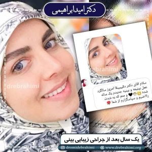 جراحی بینی طبیعی در تهران - دکتر ابراهیمی
