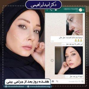 عمل بینی - دکتر ابراهیمی