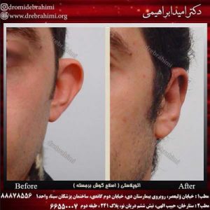 عمل گوش در تهران - دکتر ابراهییمی