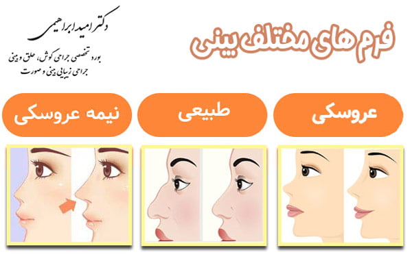 عمل بینی در تهران - دکتر امید ابراهیمی