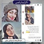 عمل بینی در تهران - دکتر ابراهیمی