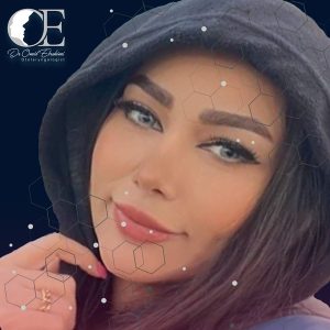 جراحی بینی نیمه فانتزی - دکتر ابراهیمی