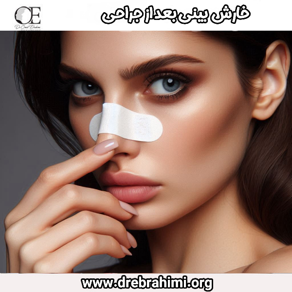 خارش بینی بعد از جراحی - دکتر امید ابراهمی 