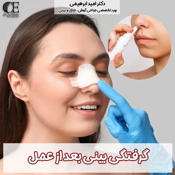 علت گرفتگی بینی بعد از عمل + درمان کیپ شدن بینی بعد عمل
