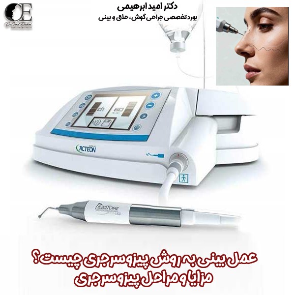عمل بینی به روش پیزوسرجری چیست؟ مزایا و مراحل پیزوسرجری