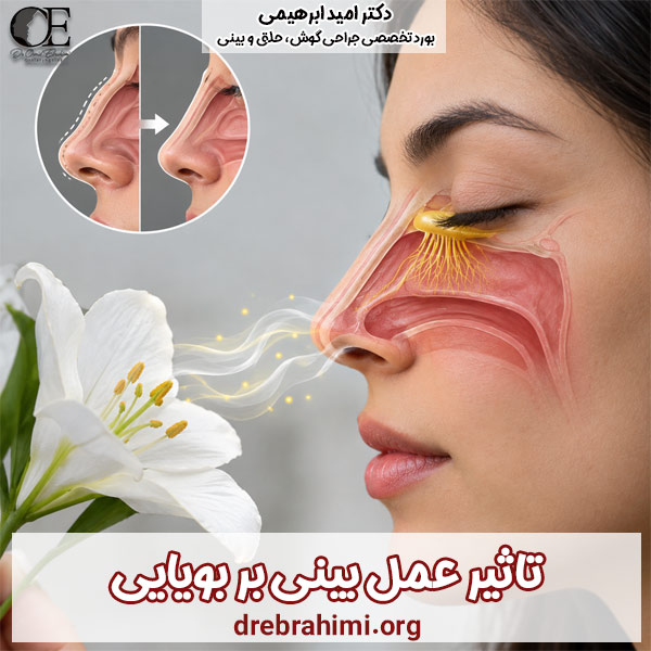 تأثیر جراحی بینی بر حس بویایی - دکتر ابراهیمی