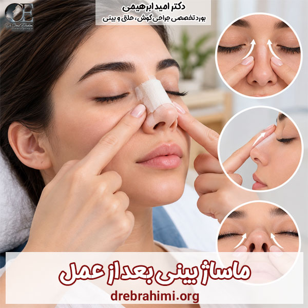 ماساژ بینی بعد از عمل - دکتر امید ابراهیمی