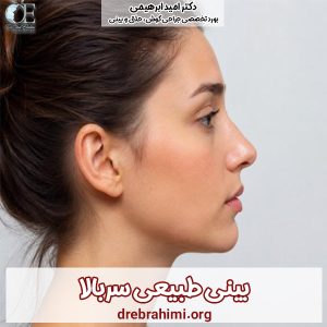 جراحی بینی طبیعی - دکتر ابراهیمی