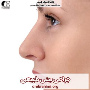 جراحی بینی طبیعی - دکتر ابراهیمی