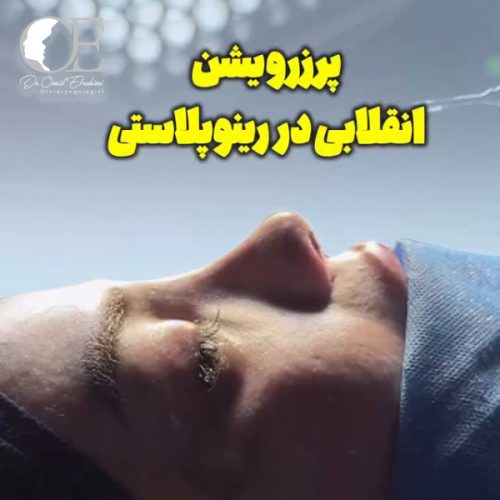 rhinoplasty.jpg295
