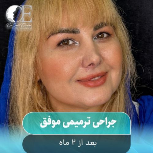 rhinoplasty.jpg296
