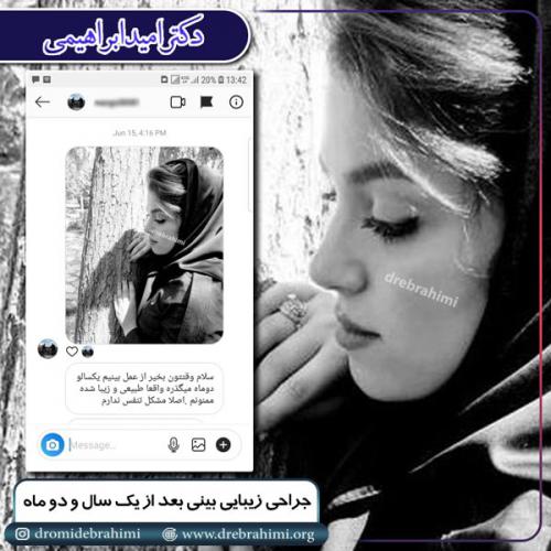 جراحی بینی 153
