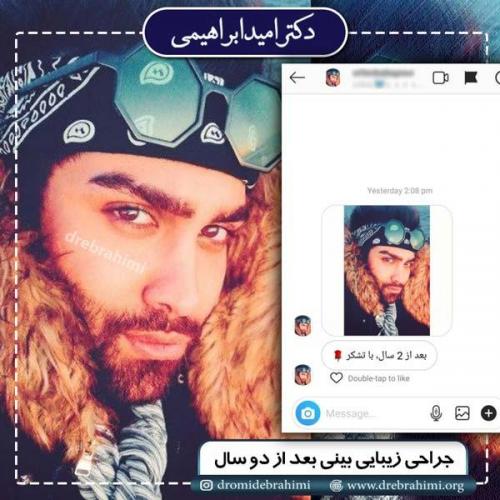 جراحی بینی 191