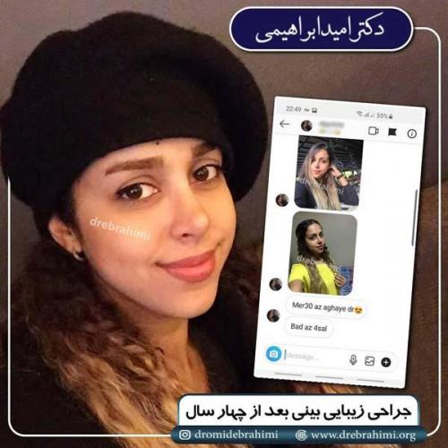 جراحی بینی 192