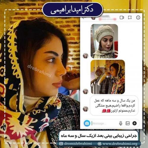 جراحی بینی 200