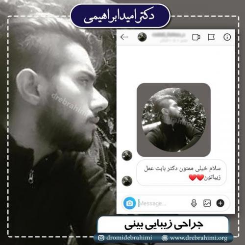 جراحی بینی 204