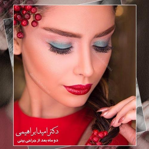 جراحی بینی 205