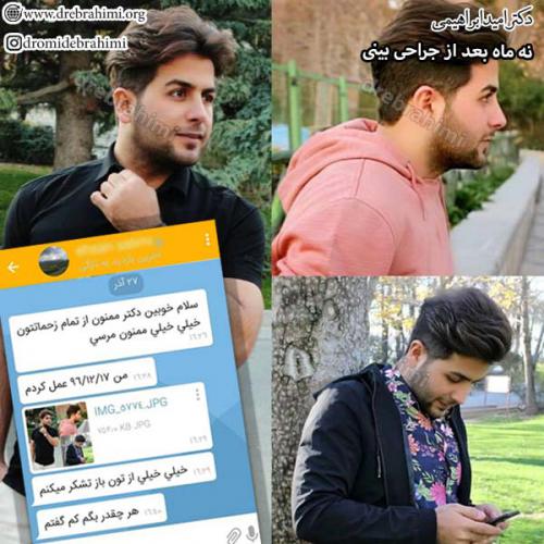 عمل-زیبایی-بینی-84